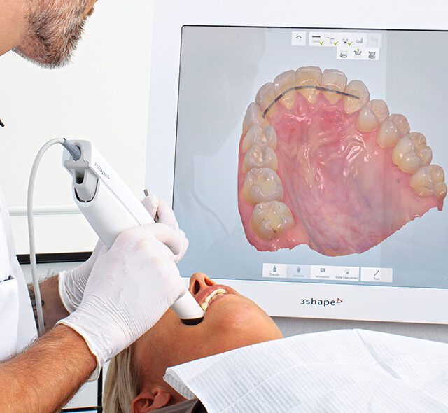 scanner-intra-orale https://sorridiallavita.it/wp-content/uploads/2026/04/scanner-intra-orale-1-640x590.jpg